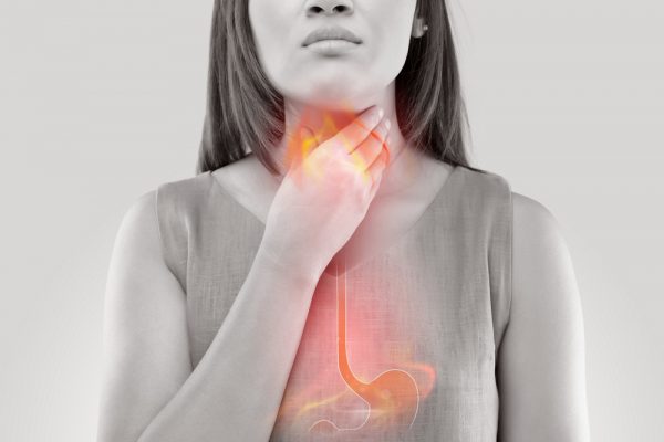 acid reflux and heartburn