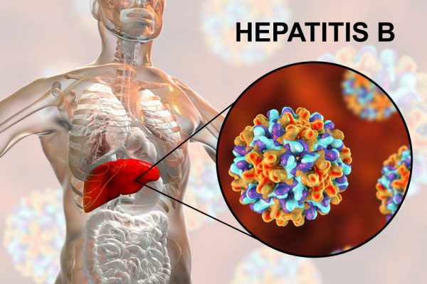 Hepatitis B and C | Symptoms, Tests, and Treatment | North Texas GI