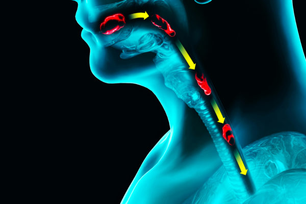 Swallowing Disorders